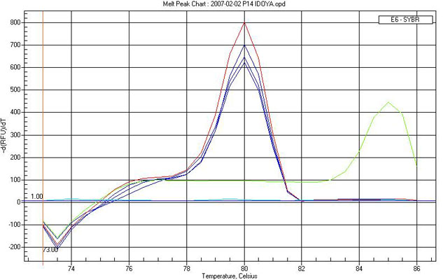 Figura 2 - Deteccin de hipermetilacin a nivel del promotor del gen p14 mediante PCR a tiempo real, en lneas celulares de neuroblastoma.
S101: DNA de sangre perifrica (control negativo), en rojo. IMD: DNA metilado in vitro (control positivo), en verde. SIMA (triplicado), en azul. 
